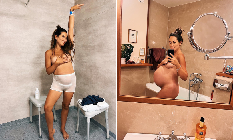 Ciara Zelmerlöws bild på kroppen efter förlossningen plockas bort av Instagram